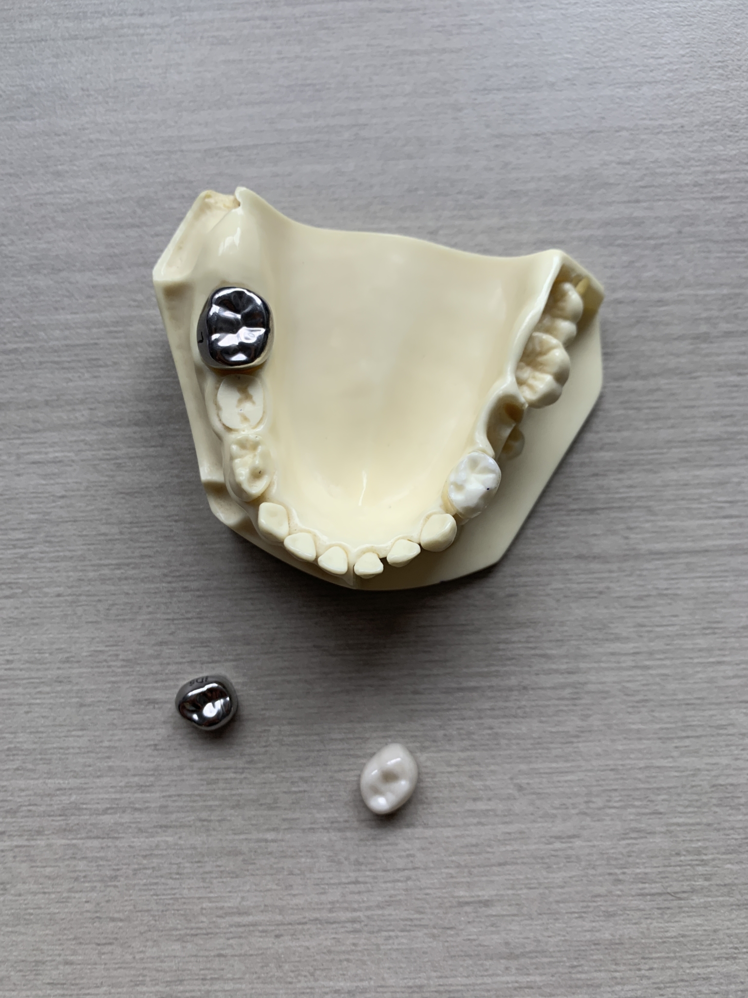 What is a children's dental crown and is there a difference between zirconia and stainless steel